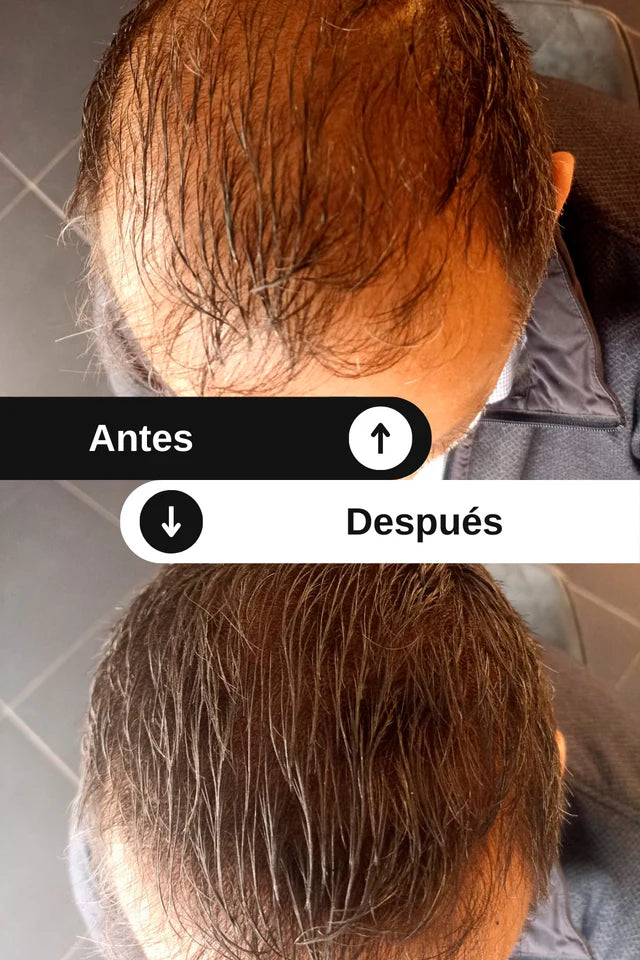Toppik - Fibras capilares