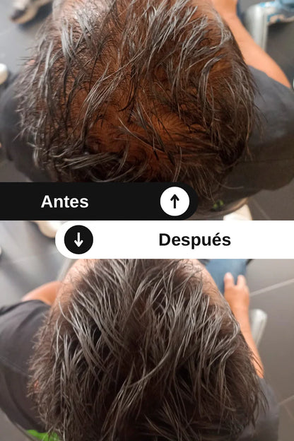Toppik - Fibras capilares