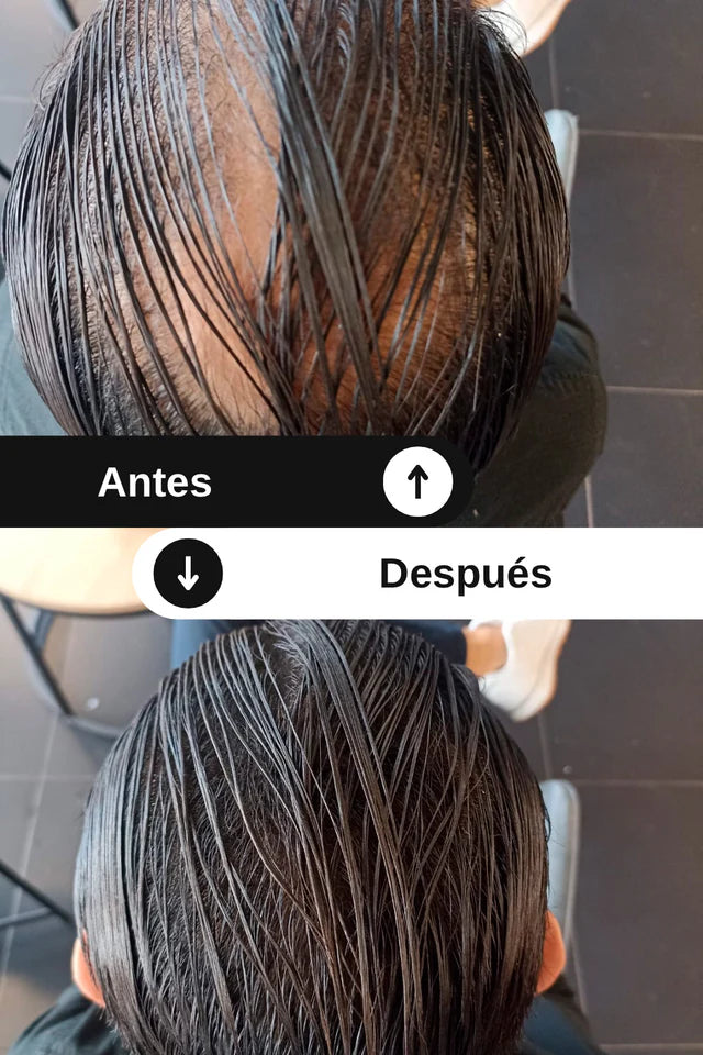 Toppik - Fibras capilares